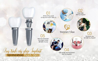 TOP 5+ Địa Chỉ Trồng Răng Implant Uy Tín Nha Trang
