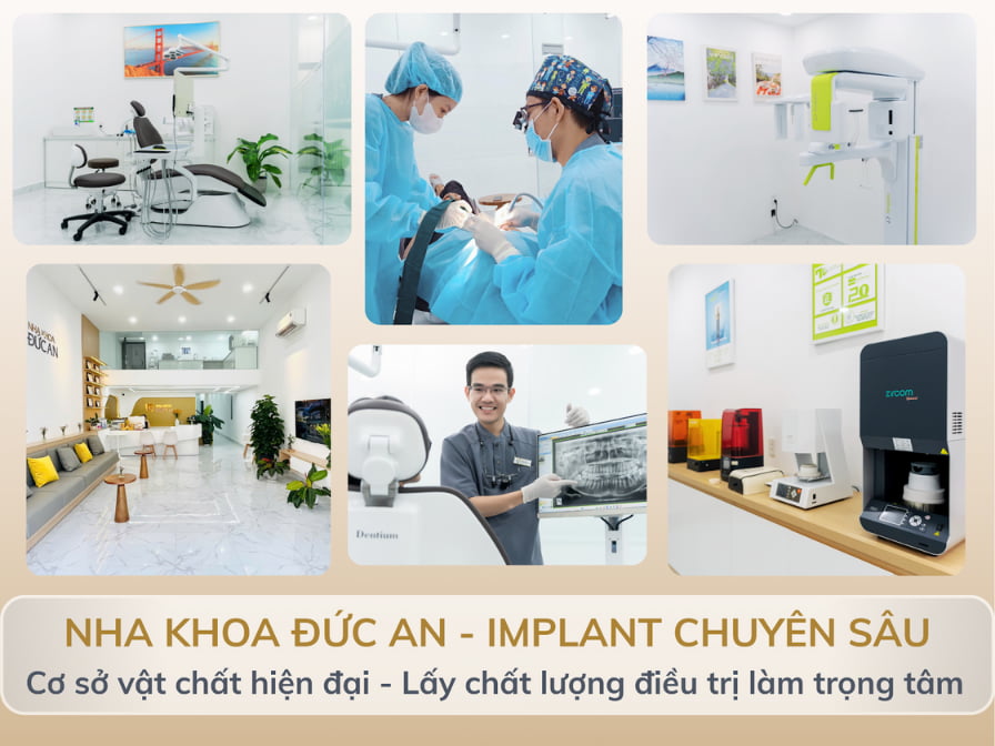 địa chỉ trồng răng Implant nha trang